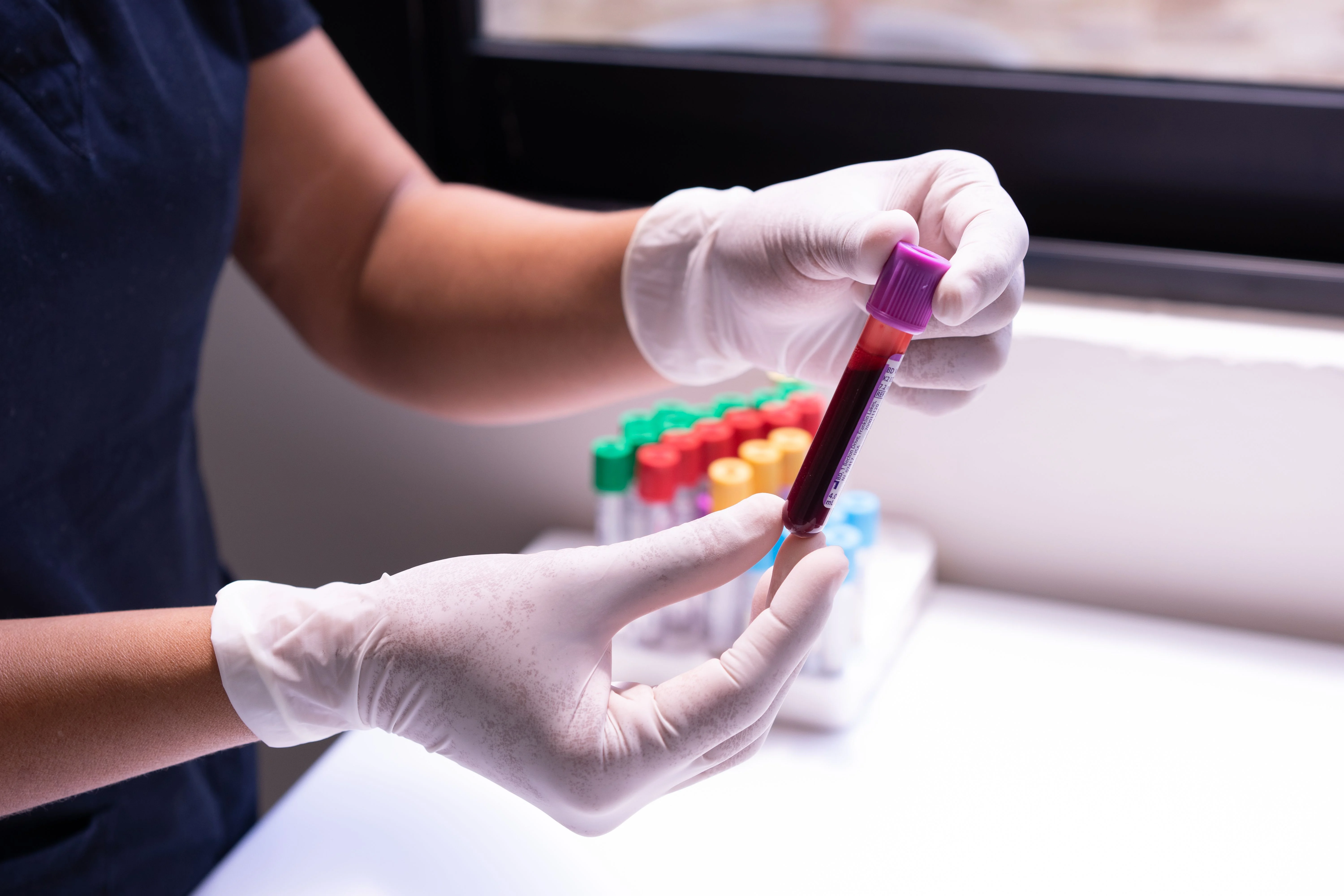 Automated Pathology Diagnostic Laboratory